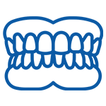 Blue line illustration of upper and lower teeth showing dental alignment and bite.